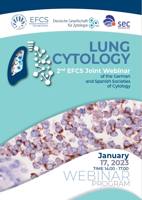Lee más sobre el artículo 17 de enero – Lung Cytology 2nd EFCS Joint webinar of German and Spanish Societies of Cytology